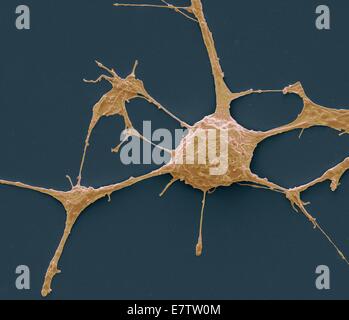 Neurone. Scanning electron micrograph (SEM) of a PC12 neurone in culture.The PC12 cell line, developed from a pheochromocytoma tumor of the rat adrenal medulla, has become a premiere model for the study of neuronal differentiation. When treated in culture