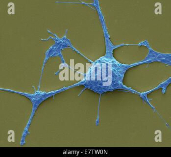 Neurone. Scanning electron micrograph (SEM) of a PC12 neurone in culture.The PC12 cell line, developed from a pheochromocytoma tumor of the rat adrenal medulla, has become a premiere model for the study of neuronal differentiation. When treated in culture