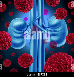 Kidney cancer medical concept as cancerous cells in a human body attacking the urinary system and renal anatomy as a symbol for Stock Photo