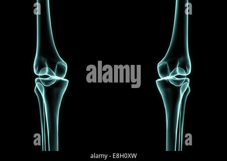 X-ray left and right knee in brightness blue with black background Stock Photo