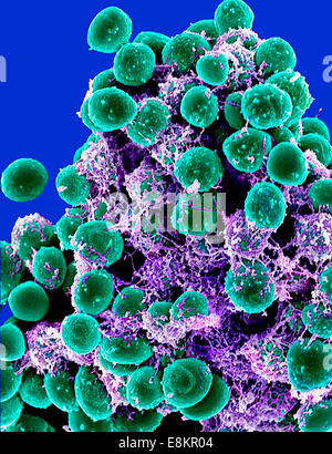 Scanning electron micrograph of clump of Staphylococcus epidermidis bacteria in extracellular matrix, which connects cells and Stock Photo