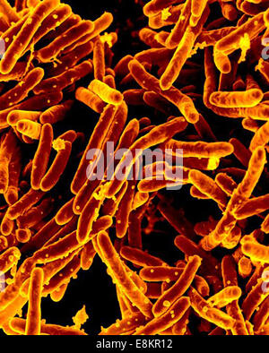 Scanning electron micrograph of Mycobacterium tuberculosis bacteria, which cause TB. Stock Photo