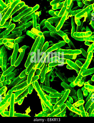 Scanning electron micrograph of Mycobacterium tuberculosis bacteria, which cause TB. Stock Photo