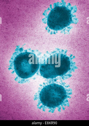 This digitally-colorized transmission electron micrograph (TEM) revealed presence of number of infectious bronchitis virus Stock Photo