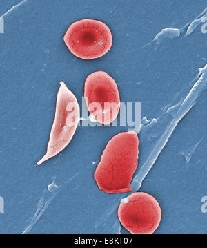 This digitally-colorized scanning electron micrograph (SEM) revealed some of comparative ultrastructural morphology between Stock Photo