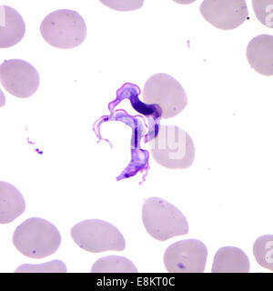 This Giemsa-stained light photomicrograph revealed presence of two Trypanosoma brucei parasites, which were found in blood Stock Photo