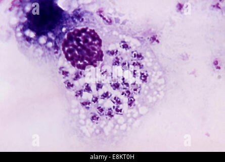 This Giemsa-stained micrograph shows Trypanosoma cruzi protozoan parasite during its leishmanial stage of development T cruzi, Stock Photo