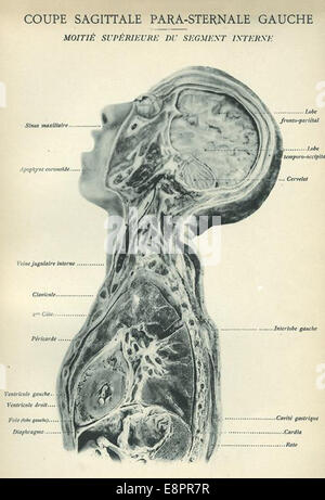 This image is a medical illustration showing sagittal sections of the ...