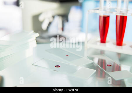 Close up of microscope slides in lab Stock Photo