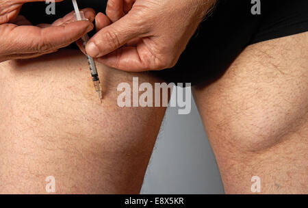 Diabetic man injecting insulin into his leg which over the years has caused lumps under the skin Stock Photo