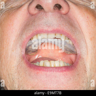 Close up of teeth guard in senior mouth Stock Photo