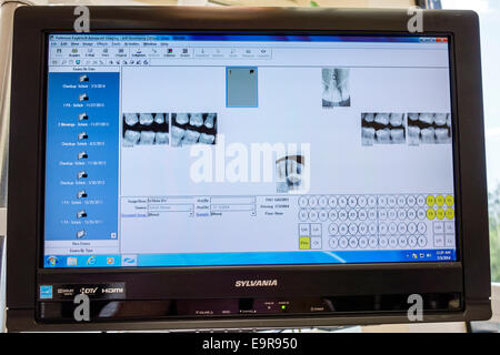 Miami Beach Florida,dentist office,computer screen monitor,teeth,tooth,xray,x-ray,FL140704001 Stock Photo