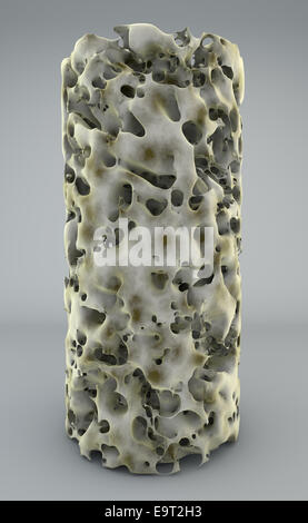 3d Section of bone with osteoporosis,anatomy bone Stock Photo - Alamy