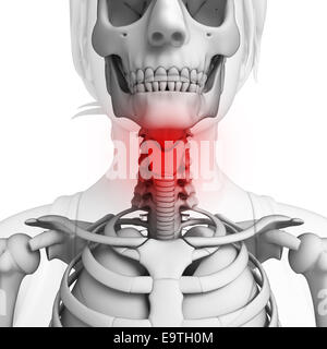 Illustration of neck pain artwork Stock Photo