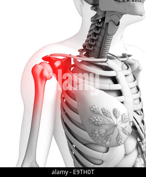 Illustration of shoulder pain artwork Stock Photo