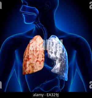 Smoker vs Non-smoker - Lungs Anatomy Stock Photo