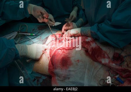 A surgeon team working together on a patient during an operation in a hospital Stock Photo