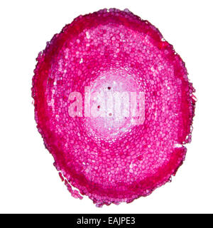 Pine tree tissue. Light micrograph of a section of pine tree stem ...