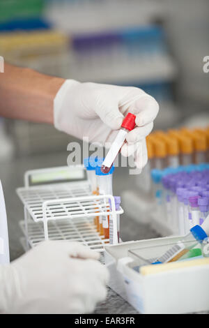 Technician Analyzing Blood Sample In Laboratory Stock Photo