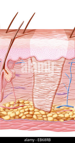 SCAR DRAWING Stock Photo