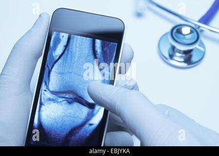 Technology use in healthcare. Doctors hands using smartphone displaying an Xray CT scan of knee Stock Photo