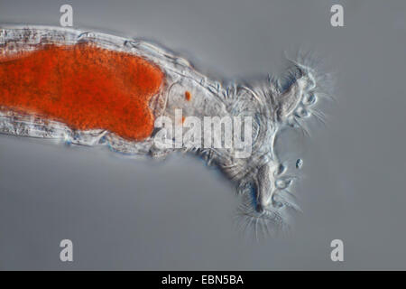 rotifers (Rotatoria), red rotifer in differential interference contrast Stock Photo