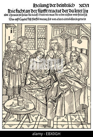 A patient with a leg fracture, 15th century, Patient mit einem Beinbruch im 15. Jahrhundert Stock Photo