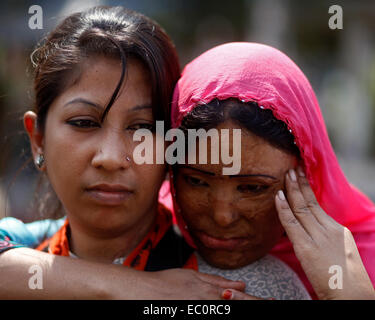 Dhaka, Bangladesh, 07th March 2014: Survivors of acid attacks, attend a human chain to protest against acid violence on the eve of the International Women's Day celebration in Dhaka, Bangladesh. According to Acid Survivors Foundation (ASF), there had been 3,184 acid attacks since February 1999 to February 2014 in Bangladesh, where 1,792 women were victims among a total of 3,512. Acid attacks are mostly common in Cambodia, Pakistan, Afganistan, India, Bangladesh and nearby other countries. It is estimated that some 80 percent of the victims of acid attacks are female and 40 percent of them are Stock Photo