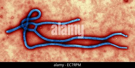 Colorized transmission electron micrograph (TEM), Created by CDC microbiologist Cynthia Goldsmith,  ultra structural morphology displayed by an Ebola virus virion Stock Photo
