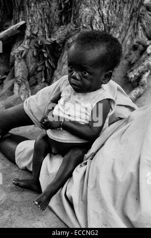 Malnourished child Quelimane in Mozambique circa 1994 Stock Photo