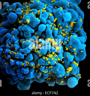 Colorized image of HIV-infected H9 T-cell. Stock Photo