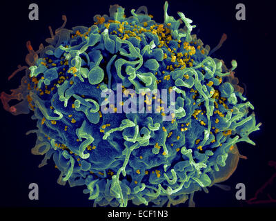 Scanning electron micrograph of HIV particles infecting a human H9 T cell. Stock Photo