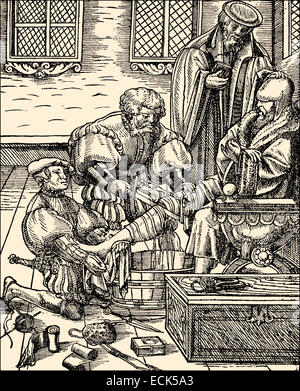 Amputation of a leg, 16th century, Amputation eines Beines im 16. Jahrhundert Stock Photo