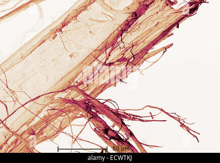 Scanning electron micrograph of chrysotile, white asbestos. Stock Photo