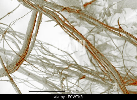 Scanning electron micrograph of chrysotile, white asbestos. Stock Photo