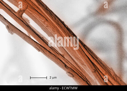 Scanning electron micrograph of chrysotile, white asbestos. Stock Photo