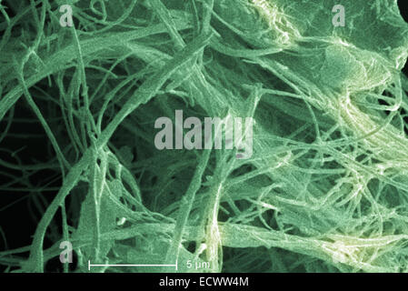 Scanning electron micrograph of chrysotile, white asbestos. Stock Photo