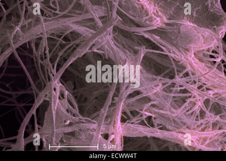 Scanning electron micrograph of chrysotile, white asbestos. Stock Photo