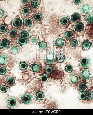 Transmission electron micrograph of herpes simplex virions. Stock Photo
