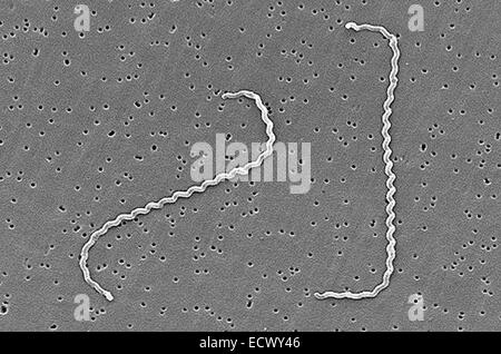 Scanning electron micrograph of Leptospira bacteria. Stock Photo