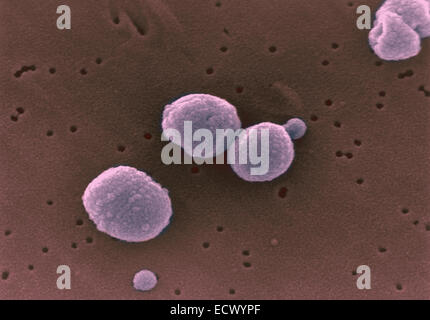 Scanning electron micrograph Streptococcus pneumoniae. Stock Photo