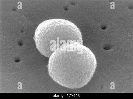 Scanning electron micrograph Streptococcus pneumoniae. Stock Photo