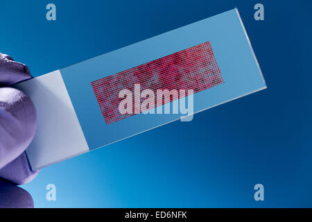 DNA microarray, DNA chip or biochip, array of nano DNA spots attached ...