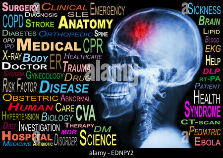 X-ray skull and 'Stroke' and Medical word cloud Stock Photo