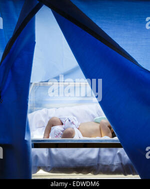 'Neonatal Jaundice' Newborn was therapy by Phototherapy Stock Photo