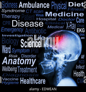 X-ray skull and Medical text Stock Photo