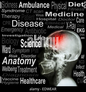 X-ray skull and Medical text Stock Photo