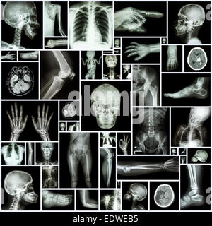 Collection X-ray multiple part of human Stock Photo