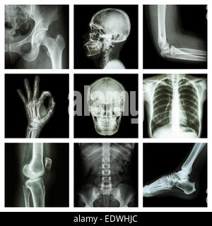 Collection X-ray part of human Stock Photo