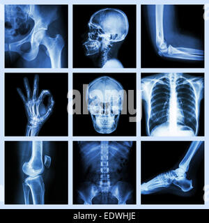 Collection X-ray part of human Stock Photo